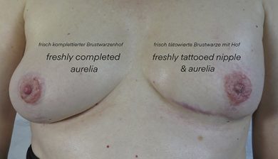 areolatattoo areolapigmentation neuesselbstwertgefühl ct cosmetictattoo medicaltattoo areola scartattoo cancertattoo bwk bwk_by_andyengel brust missnico fckcancer anatomie nippletattoo mamamia cancer cancerfighter lifeaftercancer scartattoo brustkrebs brustwarze narbentattoo cancersucks cancerfree realistictattoo allstyletattooberlin missnicotattoo allstyletattoo