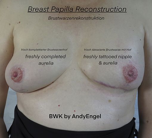 areolatattoo areolapigmentation neuesselbstwertgefühl ct cosmetictattoo medicaltattoo areola scartattoo cancertattoo bwk bwk_by_andyengel brust missnico fckcancer anatomie nippletattoo mamamia cancer cancerfighter lifeaftercancer scartattoo brustkrebs brustwarze narbentattoo cancersucks cancerfree realistictattoo allstyletattooberlin missnicotattoo allstyletattoo