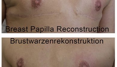 areolatattoo areolapigmentation neuesselbstwertgefühl ct cosmetictattoo medicaltattoo areola scartattoo cancertattoo bwk bwk_by_andyengel brust missnico tattoo fckcancer nippletattoo mamamia cancer cancerfighter lifeaftercancer girlpower cancersucks cancerfree allstyletattooberlin breastcancer transgender missnicotattoo allstyletattoo