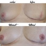 miss nico allstyletattoo berlin breast papilla reconstruction nipplesreconstruction female nipple